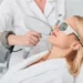 Laser hair removal